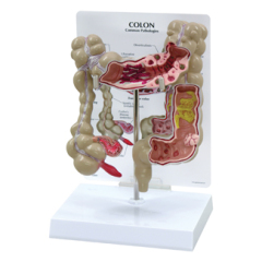 Human Colon Model ,MEDICAL PROMOTION MODEL