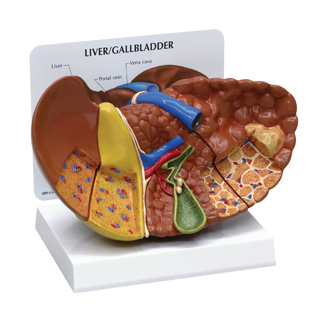 Human Liver Model with Pathologies