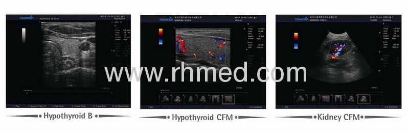 EXRH-700 DC Ordinary Type Color Doppler Ultrasound Scanner