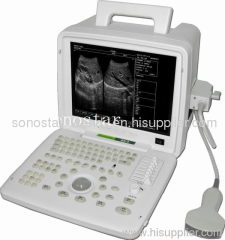 SS-4 Portable Full Digital Ultrasound Scanner