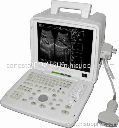 SS-4 Ultrasound Diagnosis B Scanner