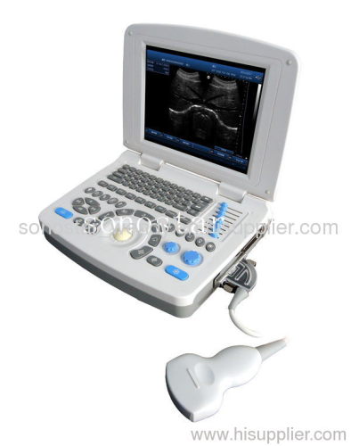 SS-10 Laptop PC Based Ultrasound B Scanner(3D image optiona