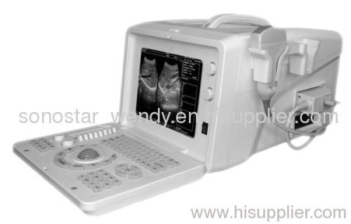 High quality SS-5Plus Ultrasound Scanner