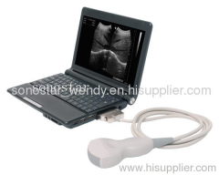 UBook-7 Ultrasound B scanner(Notebook)