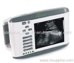 Portable SS-2 Ultrasound B Scanner(ultrasound,ultrasoni,black white,scanner)
