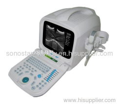 SS-7 Ultrasound Imaging Systems(ultrasound,ultrasoni,black white,scanner)