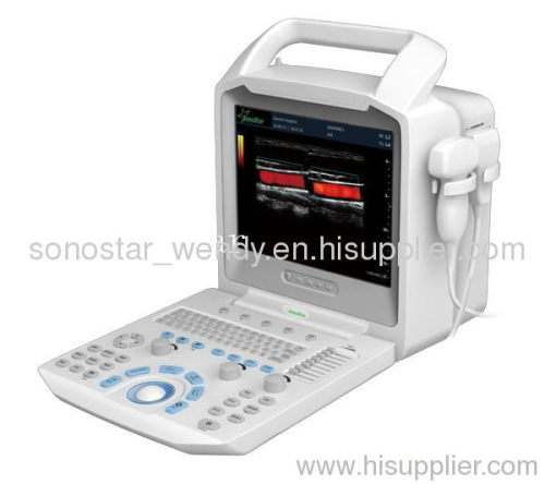SS-1000 Portable Color Doppler System Ultrasound Machine