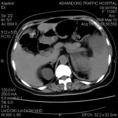 medical x-ray,agfa image film,fuji x-ray,printer images