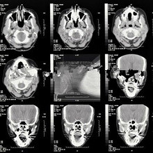 dry xray films,photographic developer,thermal scanner,digital x ray machine