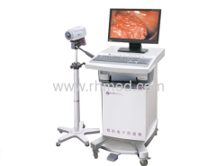 electronic colposcope diagnosis instrument