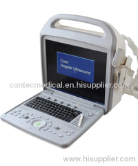 Color Doppler Ultrasonic Diagnostic System