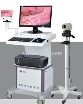 digital electronic colposcope system