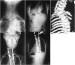 x- ray,x-ray camera -intraoral,x-ray car