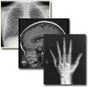 medical devices diagnostic,medical film scanner x-ray film medical film,industrial film digitizers