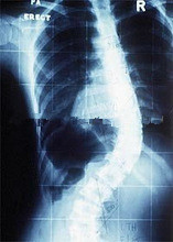 x-ray negatoscopes,dry x ray films,images medical equipment