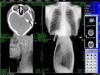 mammography images,medical diagnostic ct,medical film x-ray film used