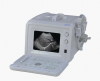 EXRH-300A Portable Ultrasound Scanner (Ordinary Type)