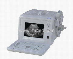 EXRH-300A Portable Ultrasound Scanner (Ordinary Type)