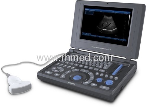 EXRH-500E Loptop Veterinary Ultrasound Scanner