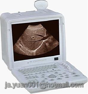 EXRH-300A Portable LCD Ultrasound Scanner (Enhanced)