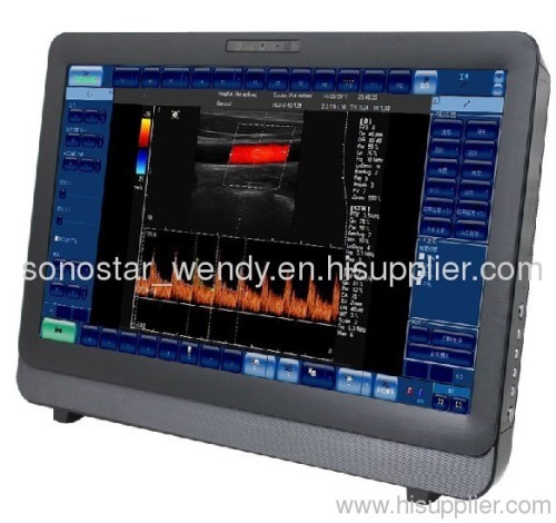 High quality C8 Color Doppler Ultrasound Scanner(Touch Screen)