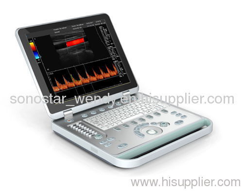 New!! C5 Ultrathin Notebook Color Doppler System