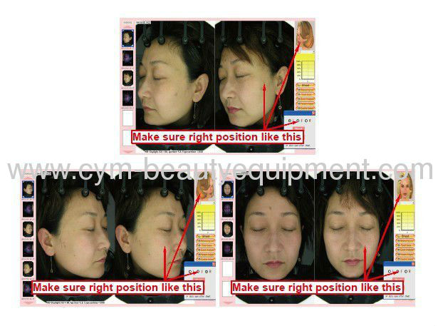 Magic mirror facial skin analyzer