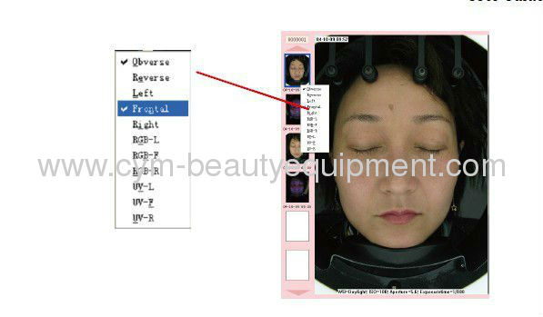 Magic mirror facial skin analyzer