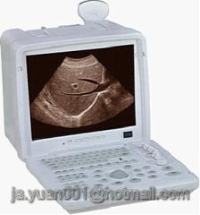 EXRH-300A Portable Ultrasound Scanner