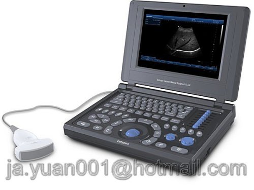 Loptop Portable Veterinary Ultrasound Scanner