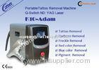 1064nm & 532nm Yag Laser Tattoo Removal Equipment