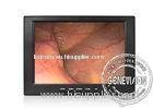 10.4" Medical LCD Display with 5ms Responsive Time , 140 / 150