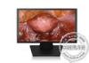 15 Inch Medical LCD Monitors , 800:1 BNC LCD Monitor for Surgery