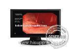 SDI Embedded Audio Medical LCD Monitors , 1280x 1024 Resolution