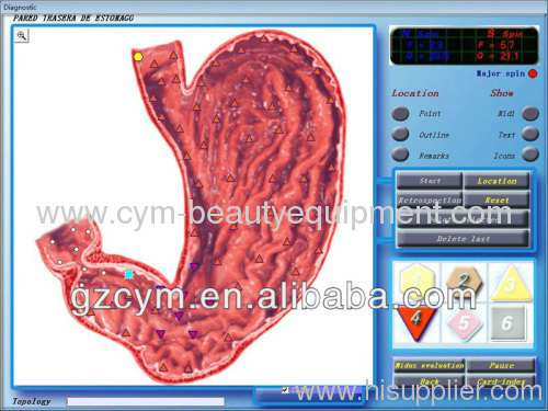 Promotion sale different languages 3d-nls non linear diagnosis system with free shipping