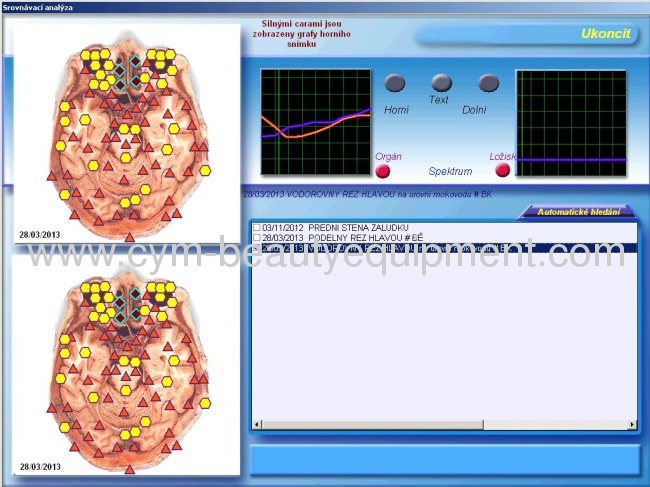 Czech version 3D NLS health analyzer