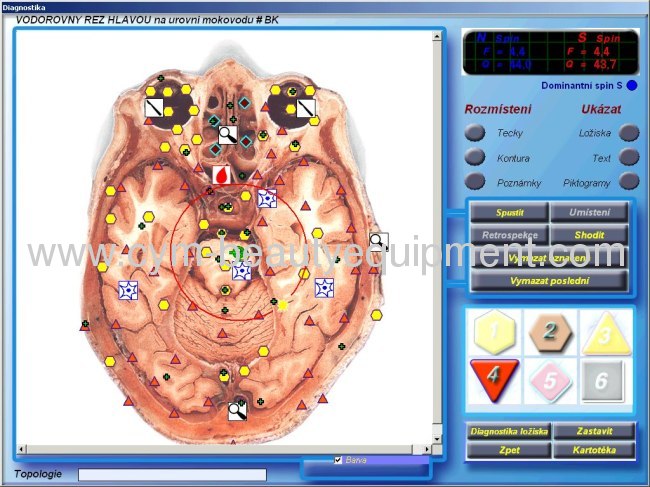 Czech version 3D NLS health analyzer