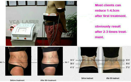 Professional Lipolaser Slimming System Home Use Machine