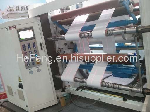 trusted electrostatic eliminator generator and bar