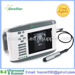 2. SS-2V Veterinary Ultrasound B Scanner