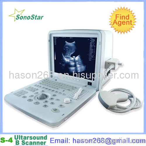 SS-4 Ultrasound Diagnosis B Scanner(