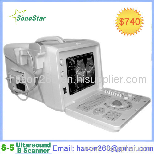 SS-5 Ultrasound Imaging Systems(ultrasound
