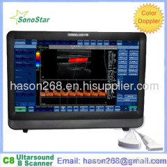 C8 Color Doppler Ultrasound System