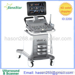 SS-2200 Color Doppler System