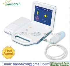 SB-1Plus PBS Ultrasound Palm Bladder Scanner