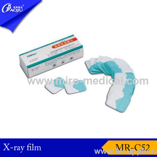 dental x-ray film developer