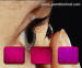 Contact Lens