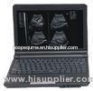 Laptop Diagnostic Ultrasound System With High-Resolution