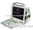 Portable Color Doppler Diagnostic Ultrasound System / Machine