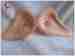 lightweight realistic breast prosthesis